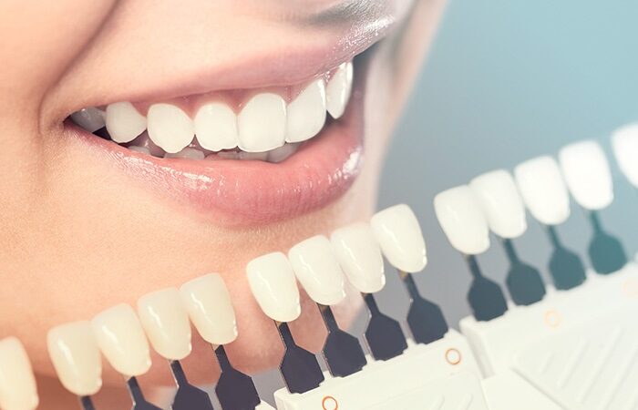 A Brighter Smile Awaits: Cosmetic Dentistry In Adelaide