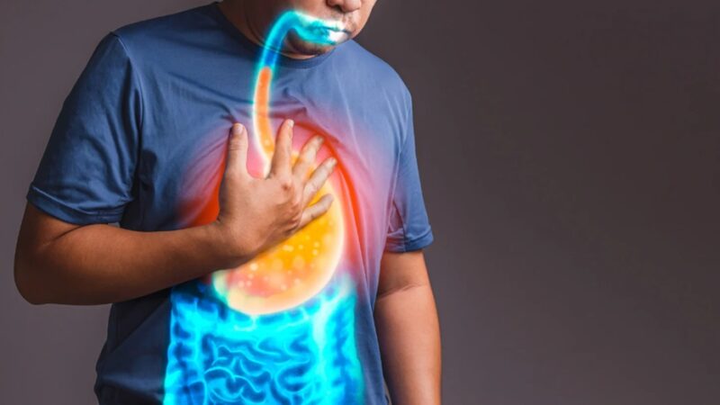 Understanding the Long-Term Effects of Untreated Gastroesophageal Reflux Disease