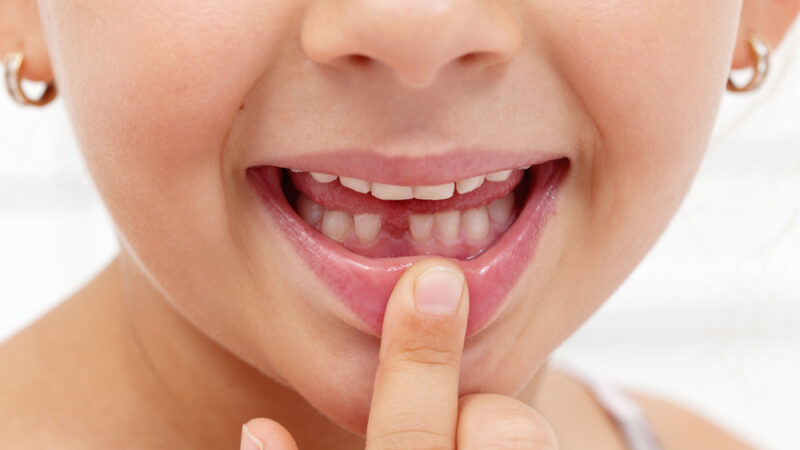 The Importance of Early Orthodontic Evaluation for Children