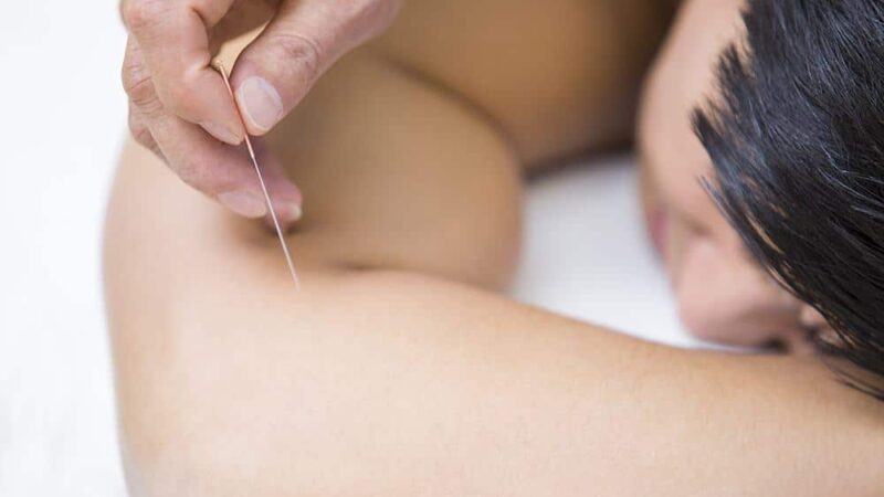 Insight Into The Use Of Acupuncture In Pain Management By Specialists