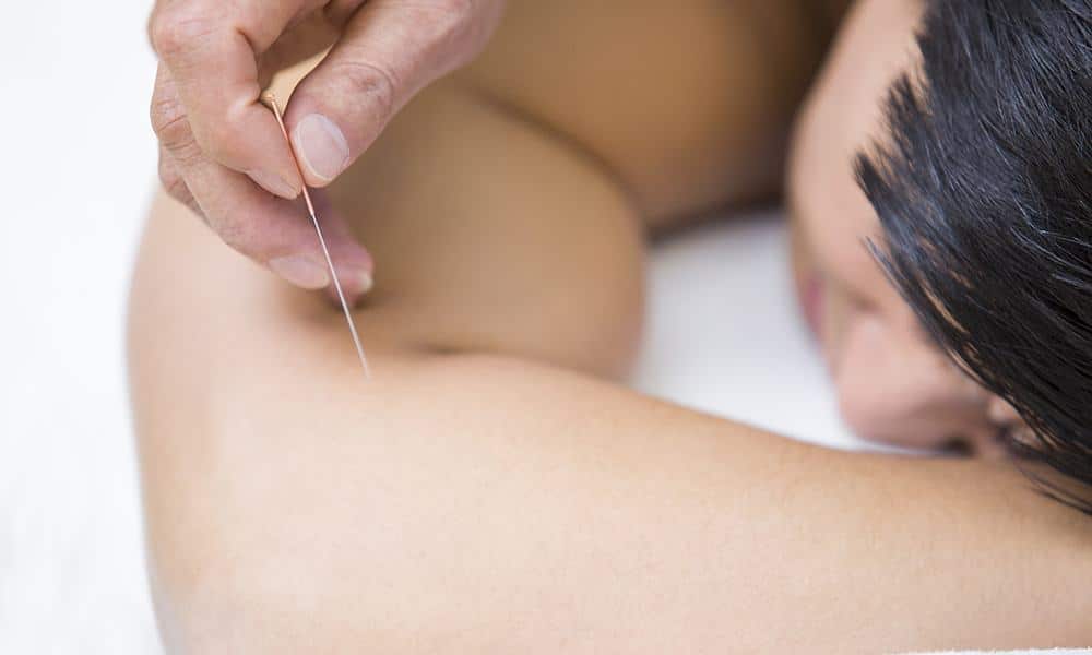 Insight Into The Use Of Acupuncture In Pain Management By Specialists