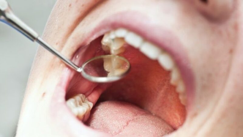 What Can I Do if My Tooth Pain is Unbearable?