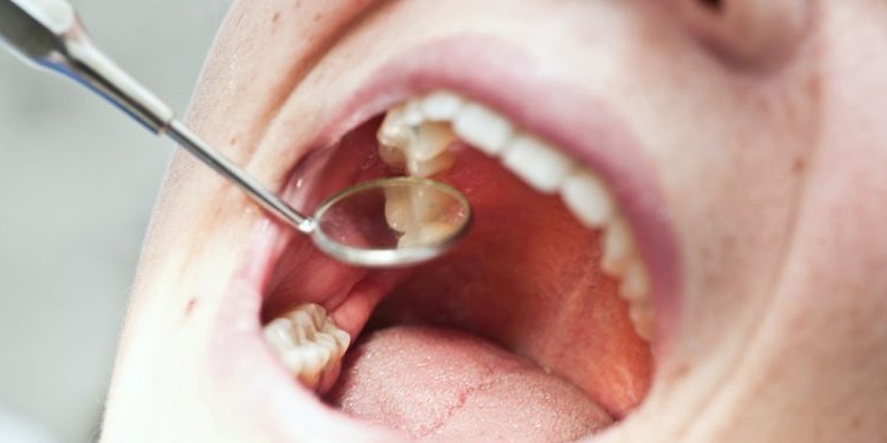 What Can I Do if My Tooth Pain is Unbearable?