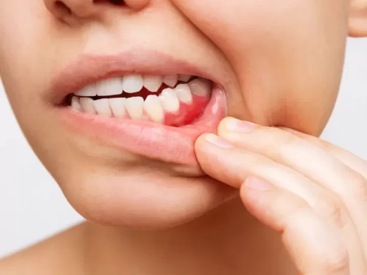 The Importance Of Oral Cancer Screenings In General Dentistry