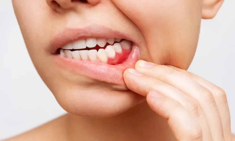 The Importance Of Oral Cancer Screenings In General Dentistry