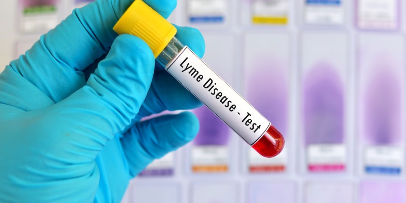 When You Need a Lyme Disease Test